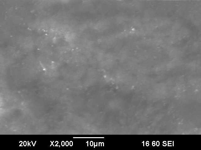 Здоровый детский зуб.jpg