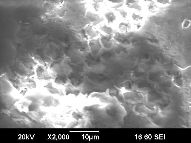 Деминерализация детский.jpg