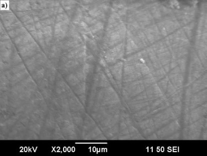 здоровый взрослый зуб.jpg